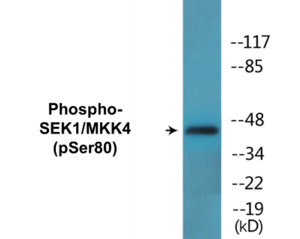 SEK1 (phospho Ser80) Cell Based ELISA Kit (A102405-296)