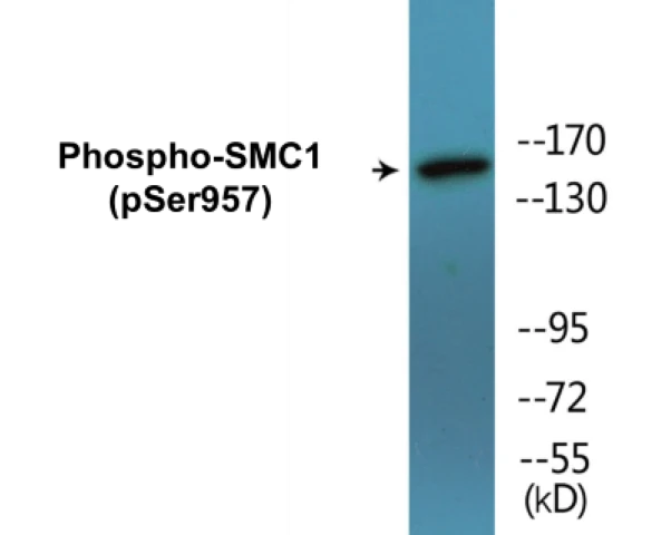 SMC1 (phospho Ser957) Cell Based ELISA Kit (A102656-296)