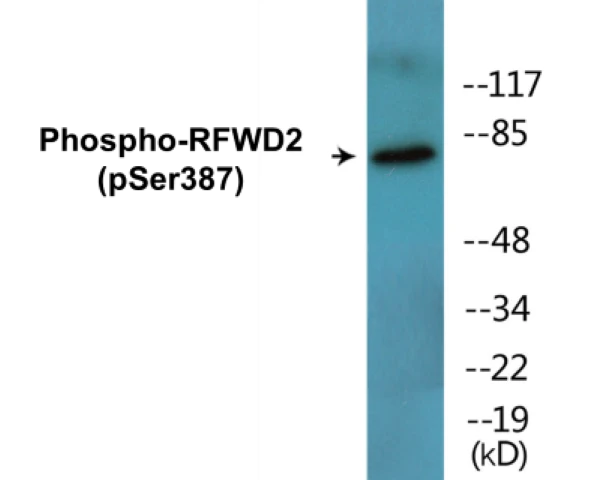 RFWD2 (phospho Ser387) Cell Based ELISA Kit (A102634-296)