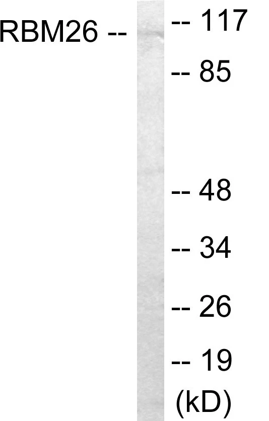 RBM26 Cell Based ELISA Kit (A103481-96)