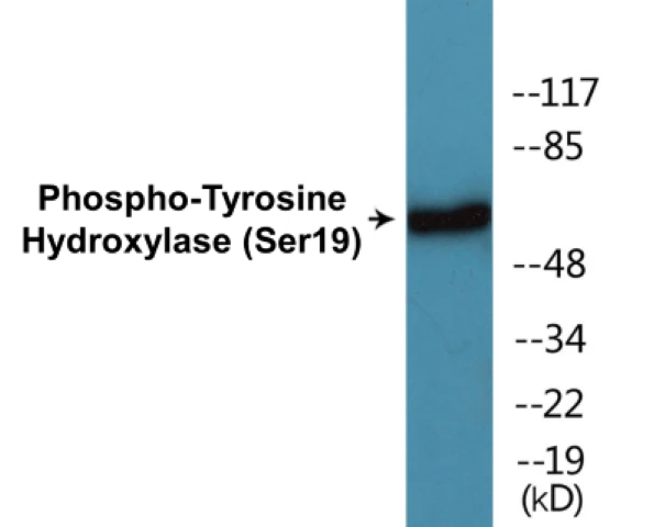 Tyrosine Hydroxylase (phospho Ser19) Cell Based ELISA Kit (A102481-296)