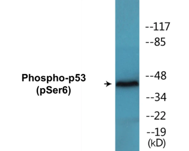 p53 (phospho Ser6) Cell Based ELISA Kit (A102770-296)