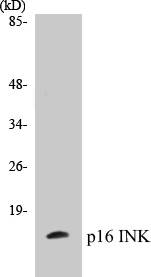 p16INK Cell Based ELISA Kit (A103407-96)