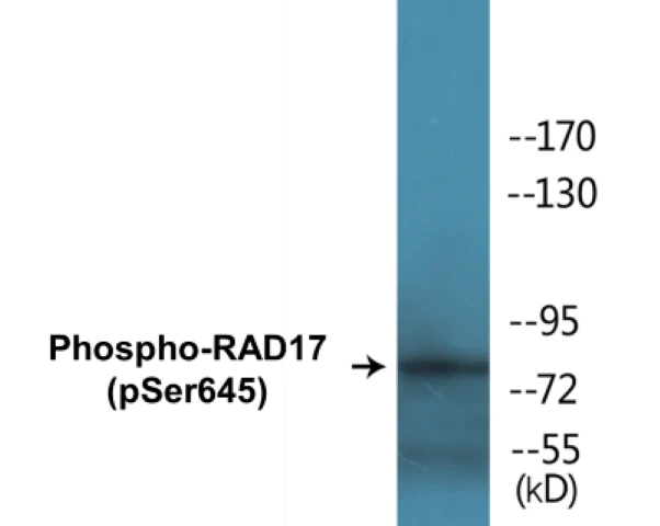 RAD17 (phospho Ser645) Cell Based ELISA Kit (A102615-296)