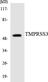 TMPRSS3 Cell Based ELISA Kit (A103404-96)