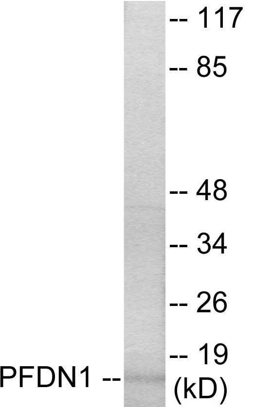 PFDN1 Cell Based ELISA Kit (A103464-96)