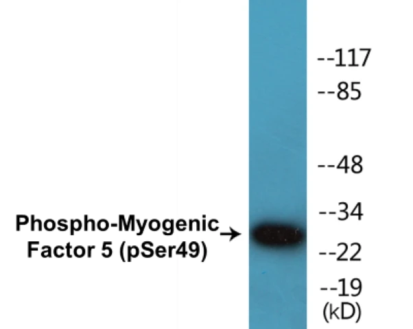 Myogenic Factor 5 (phospho Ser49) Cell Based ELISA Kit (A102608-296)