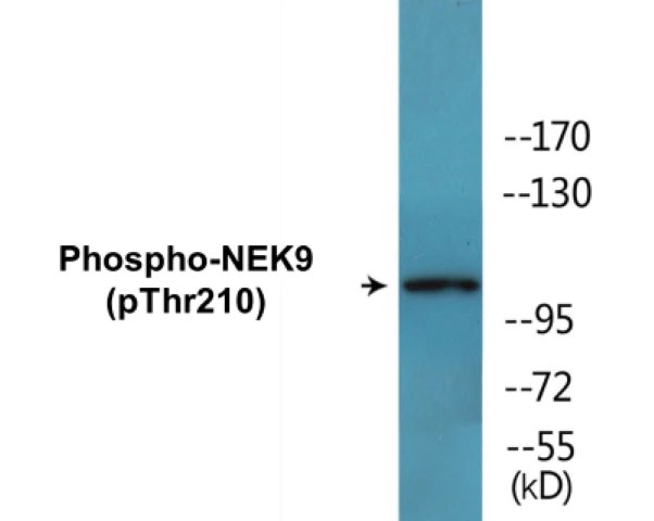 NEK9 (phospho Thr210) Cell Based ELISA Kit (A102319-296)