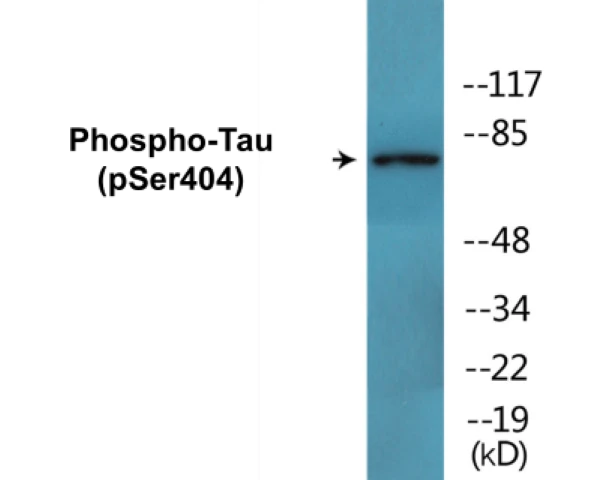 Tau (phospho Ser404) Cell Based ELISA Kit (A102408-296)