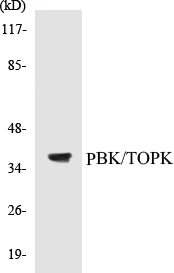 TOPK Cell Based ELISA Kit (A103727-96)