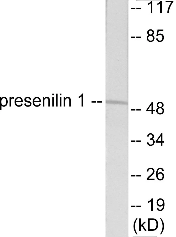 Presenilin 1 Cell Based ELISA Kit (A103618-96)