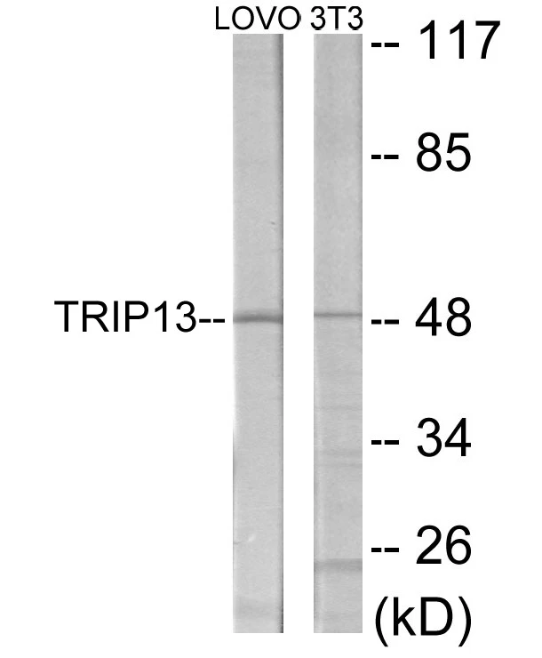 TRIP13 Cell Based ELISA Kit (A103028-96)