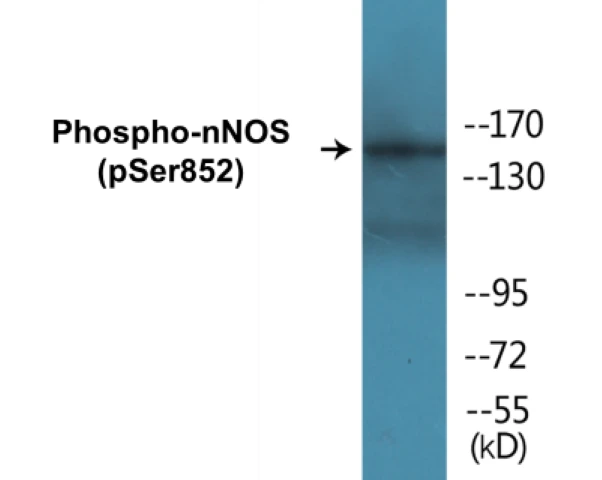 nNOS (phospho Ser852) Cell Based ELISA Kit (A102297-296)