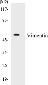 Vimentin Cell Based ELISA Kit (A102948-96)