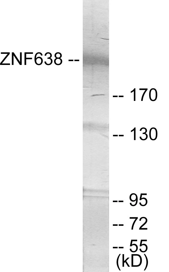 ZNF638 Cell Based ELISA Kit (A103659-96)