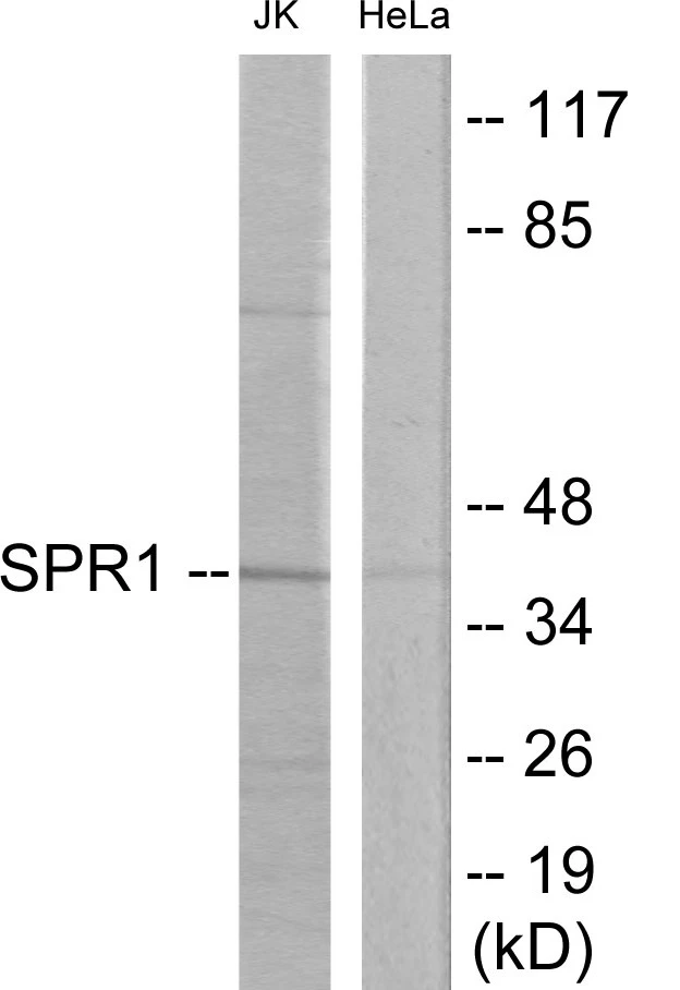 SPR1 Cell Based ELISA Kit (A103502-96)