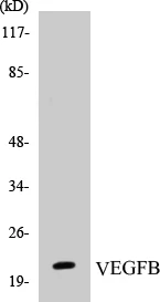 VEGFB Cell Based ELISA Kit (A103049-96)