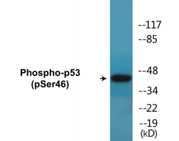 p53 (phospho Ser46) Cell Based ELISA Kit (A102764-296)