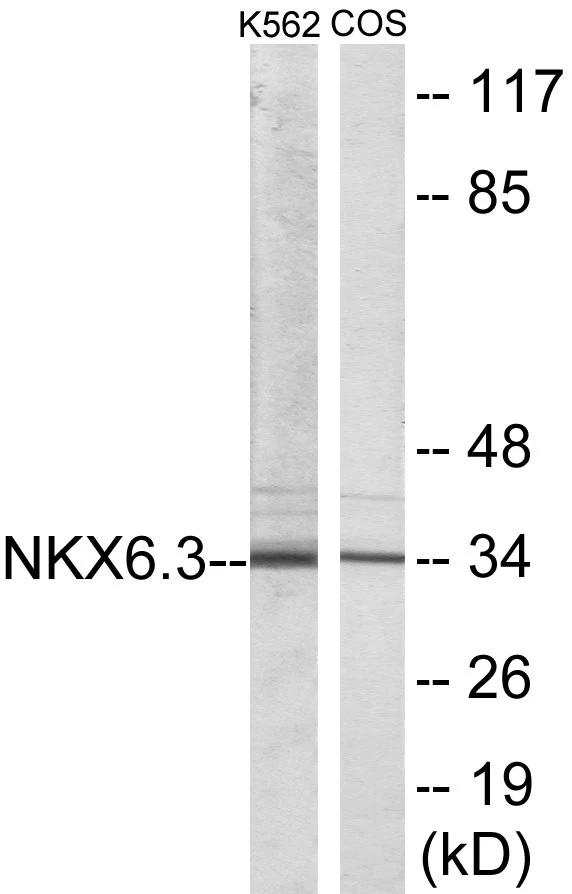 NKX6.3 Cell Based ELISA Kit (A103415-96)