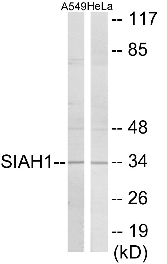 SIAH1 Cell Based ELISA Kit (A103171-96)