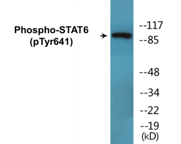 STAT6 (phospho Tyr641) Cell Based ELISA Kit (A102129-296)