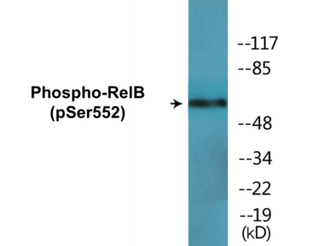 RelB (phospho Ser552) Cell Based ELISA Kit (A102655-296)