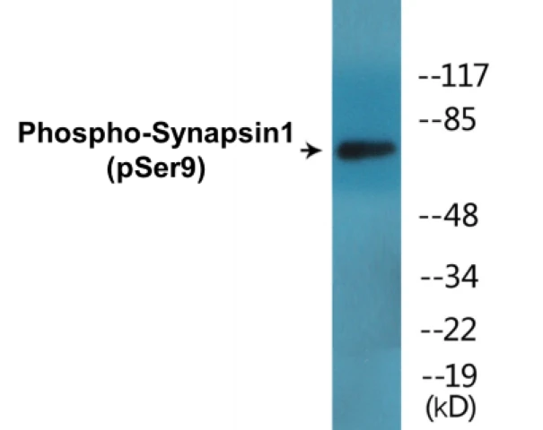 Synapsin1 (phospho Ser9) Cell Based ELISA Kit (A102052-296)