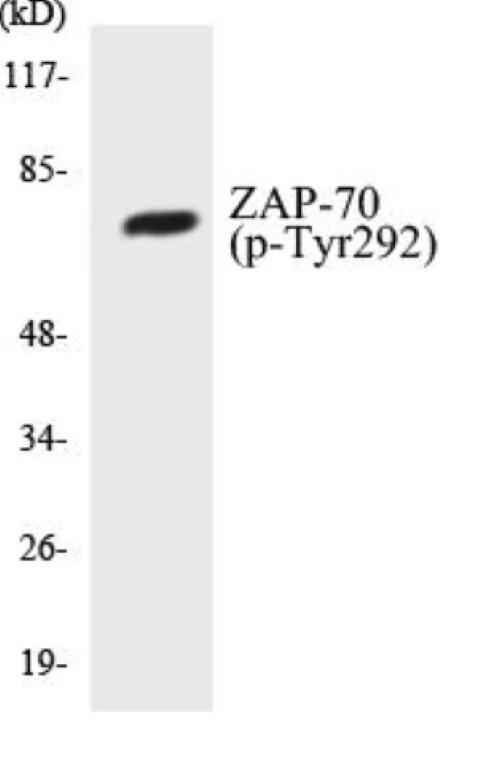 ZAP-70 (phospho Tyr292) Cell Based ELISA Kit (A102600-296)