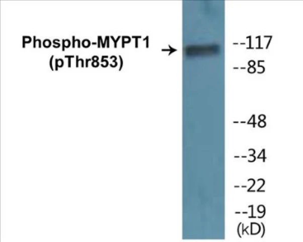 MYPT1 (phospho Thr853) Cell Based ELISA Kit (A102121-296)