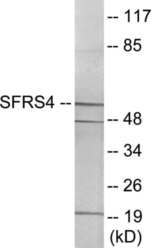 SFRS4 Cell Based ELISA Kit (A103475-96)