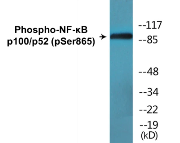 NF-kB p100 / p52 (phospho Ser865) Cell Based ELISA Kit (A102119-296)