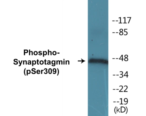 Synaptotagmin (phospho Ser309) Cell Based ELISA Kit (A102465-296)