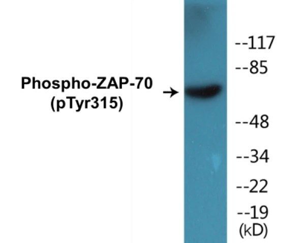 ZAP-70 (phospho Tyr315) Cell Based ELISA Kit (A103782-296)