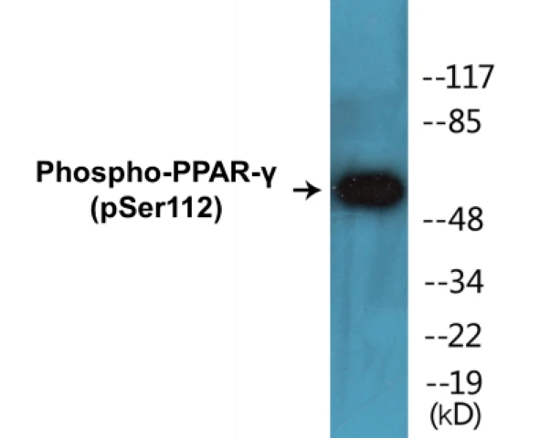 PPAR gamma (phospho Ser112) Cell Based ELISA Kit (A102509-296)