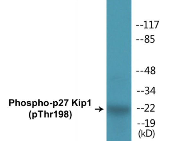 p27 Kip 1 (phospho Thr198) Cell Based ELISA Kit (A102778-296)