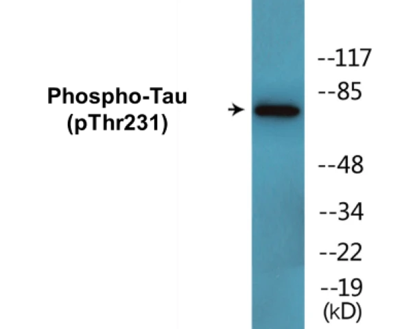 Tau (phospho Thr231) Cell Based ELISA Kit (A102446-296)