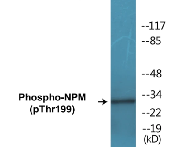 NPM (phospho Thr199) Cell Based ELISA Kit (A102427-296)