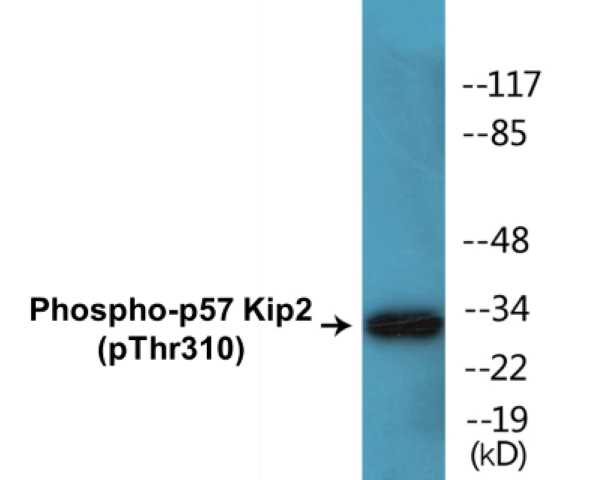 p57 Kip 2 (phospho Thr310) Cell Based ELISA Kit (A102686-296)