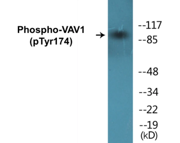 VAV1 (phospho Tyr174) Cell Based ELISA Kit (A102273-296)