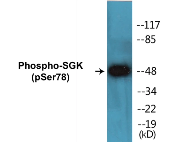 SGK (phospho Ser78) Cell Based ELISA Kit (A102476-296)