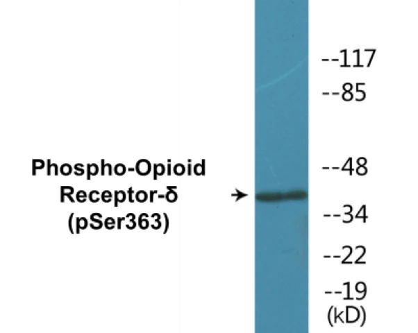 Opioid Receptor delta (phospho Ser363) Cell Based ELISA Kit (A102365-296)