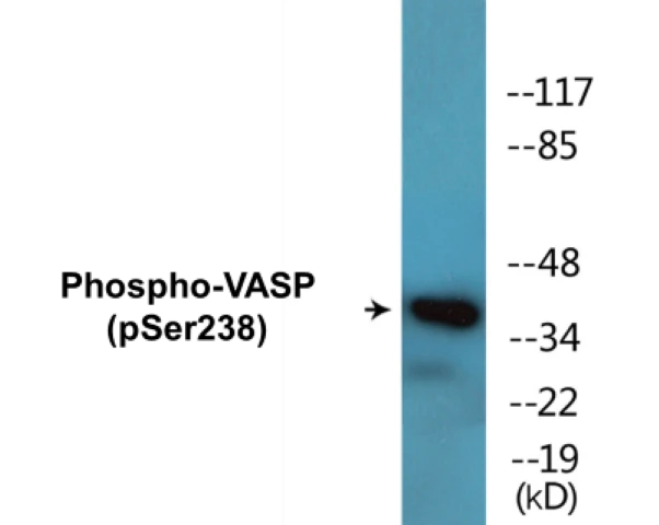 VASP (phospho Ser238) Cell Based ELISA Kit (A102343-296)