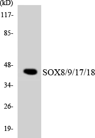 SOX8 + 9 + 17 + 18 Cell Based ELISA Kit (A103360-96)