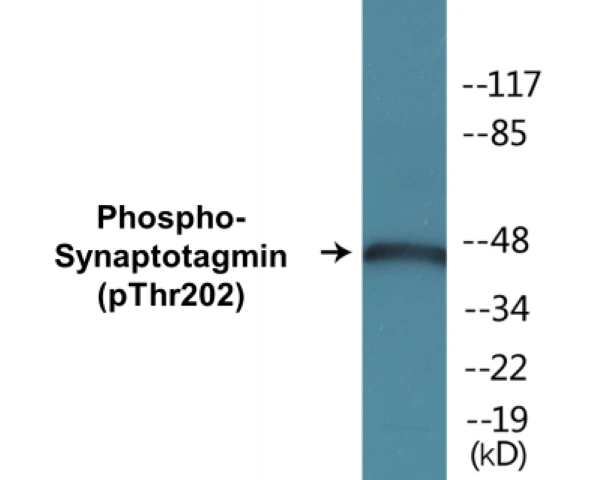 Synaptotagmin (phospho Thr202) Cell Based ELISA Kit (A102466-296)