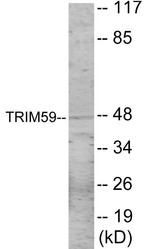 TRIM59 Cell Based ELISA Kit (A103420-96)