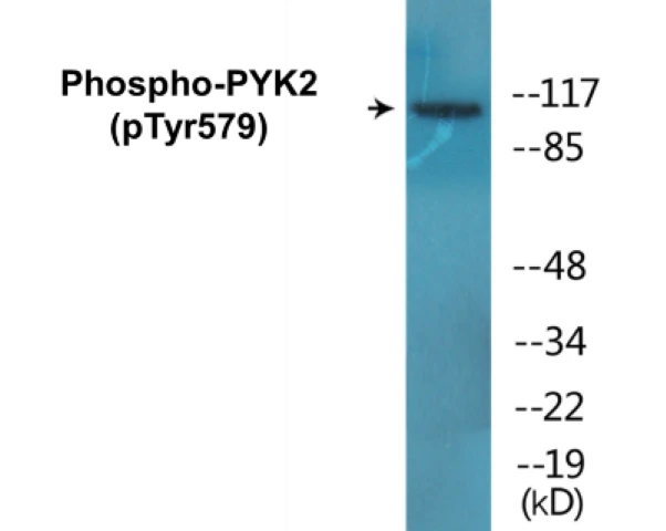 PYK2 (phospho Tyr579) Cell Based ELISA Kit (A102354-296)