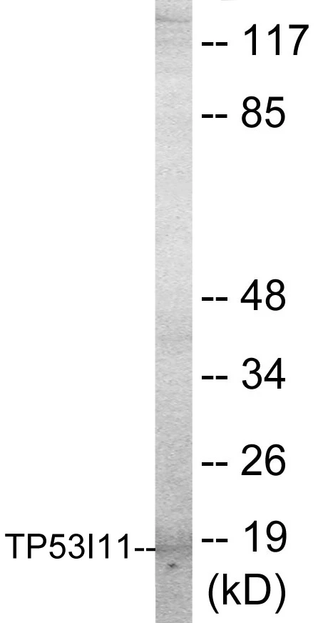 TP53I11 Cell Based ELISA Kit (A103638-96)