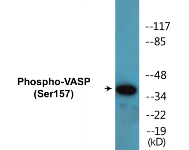 VASP (phospho Ser157) Cell Based ELISA Kit (A102289-296)