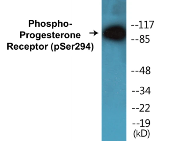 Progesterone Receptor (phospho Ser294) Cell Based ELISA Kit (A102366-296)