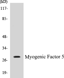 Myogenic Factor 5 Cell Based ELISA Kit (A103362-96)